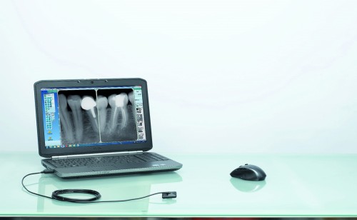 Radiowizjograf cyfrowy Owandy OPTEO USB T1 zdjęcie 2