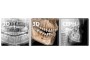 Tomograf 3D - LargeV Smart3D-X zdjęcie 9