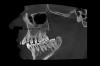 pol_pl_Smart3D-X-PRO-4647_11.jpg