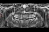 pol_pl_Smart3D-X-PRO-4647_10.jpg