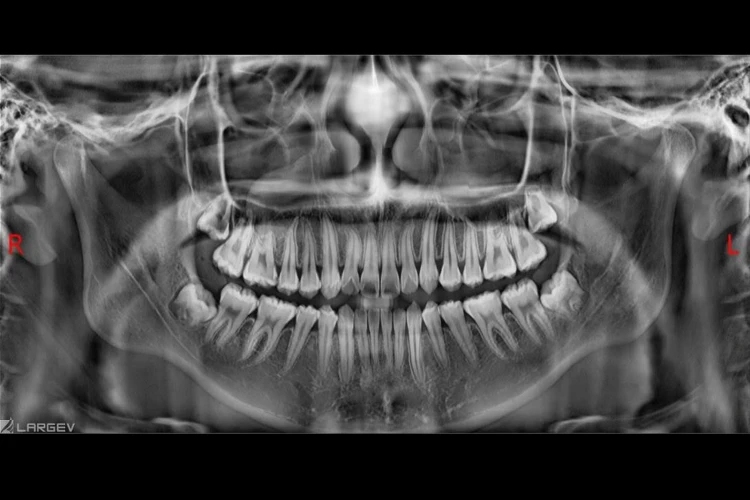 pol_pl_Smart3D-X-PRO-4647_10.jpg