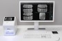 Skaner płytek obrazowych - Dürr Dental VistaScan Mini View 2.0 zdjęcie 5